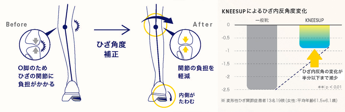 ひざの負担を軽減。アシックスウォーキング「ニーズアップ」その実力を体験