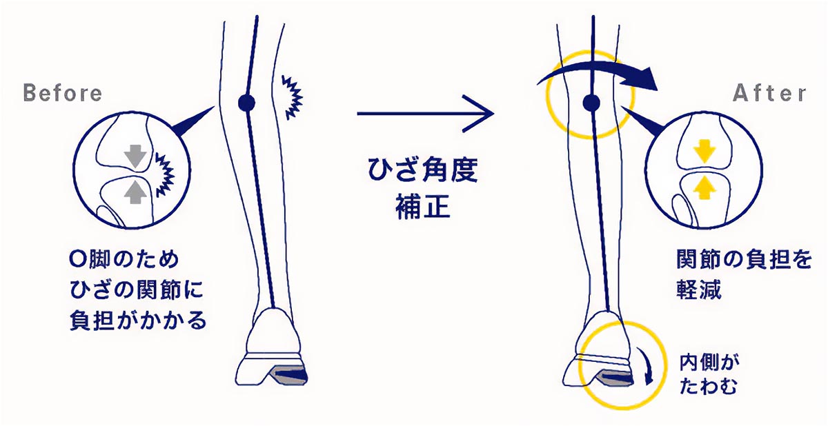 ひざに不安を感じる方へ――快適な歩行をお届けしたい。その思いから生まれた「KNEESUP(ニーズアップ)」